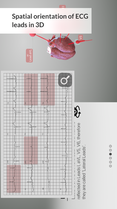 3D ECG Leadsのおすすめ画像6