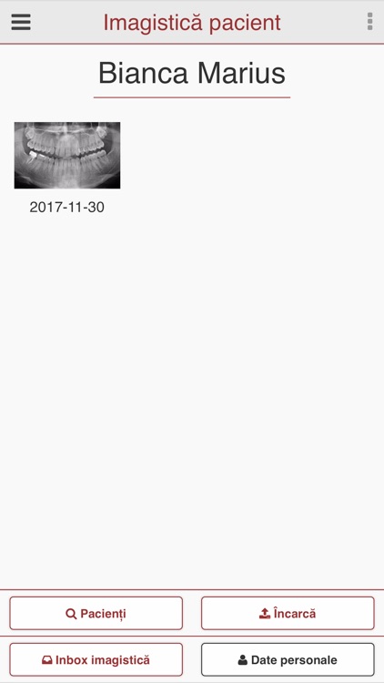 DentaVisRX - dROOT screenshot-4
