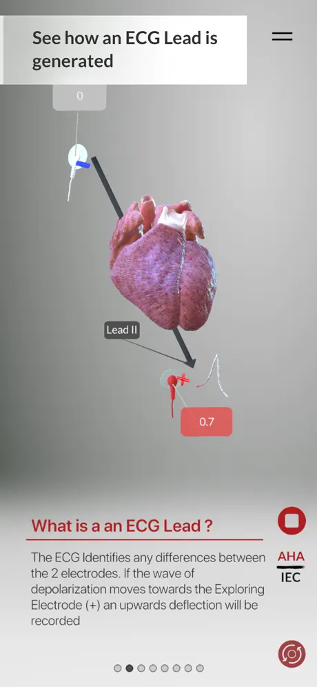 3D ECG Leads