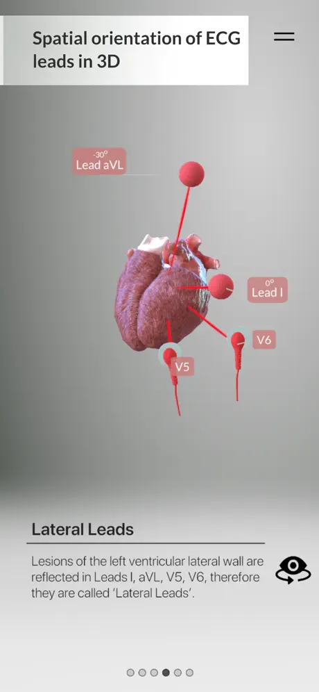 3D ECG Leads