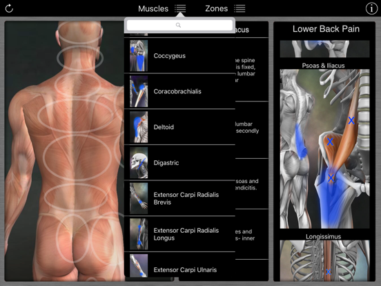 Muscle Trigger Points iPad app afbeelding 4