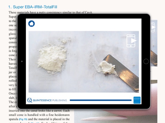 Screenshot #6 pour Microsurgical Endodontics