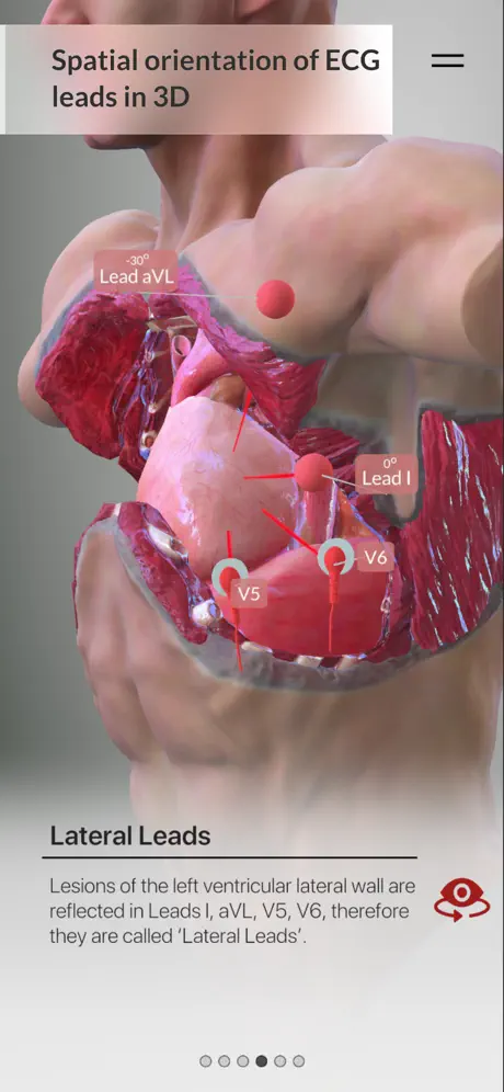3D ECG Leads