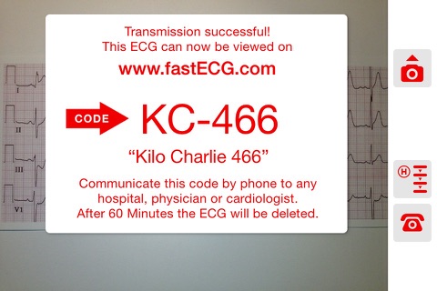 fastECG screenshot 2