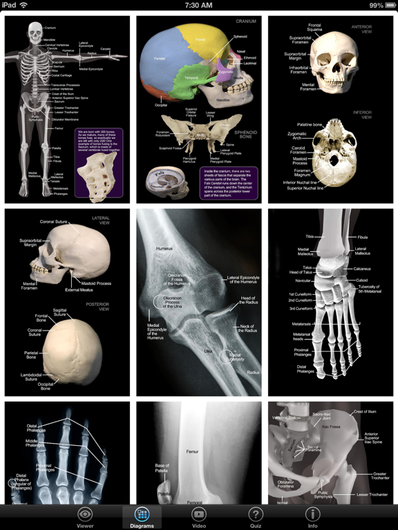 Skeletal Anatomy 3Dのおすすめ画像5