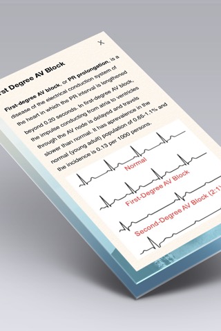 心電図ブック - ECG (EKG) Booksのおすすめ画像2