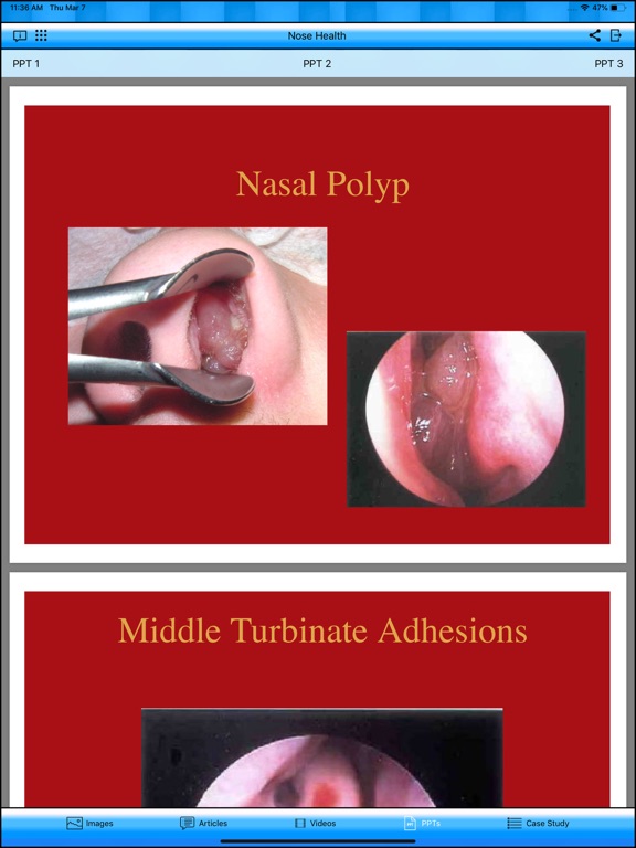 Nose Health iPad screenshot