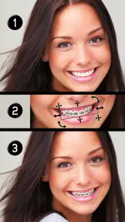brace face iphone resimleri 1