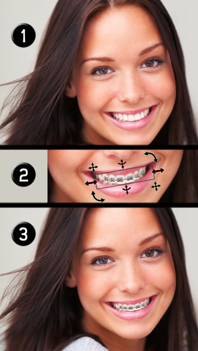 歯列矯正装置を付けよう (Brace Face)のおすすめ画像1