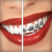 Aparelho dental (Brace Face)