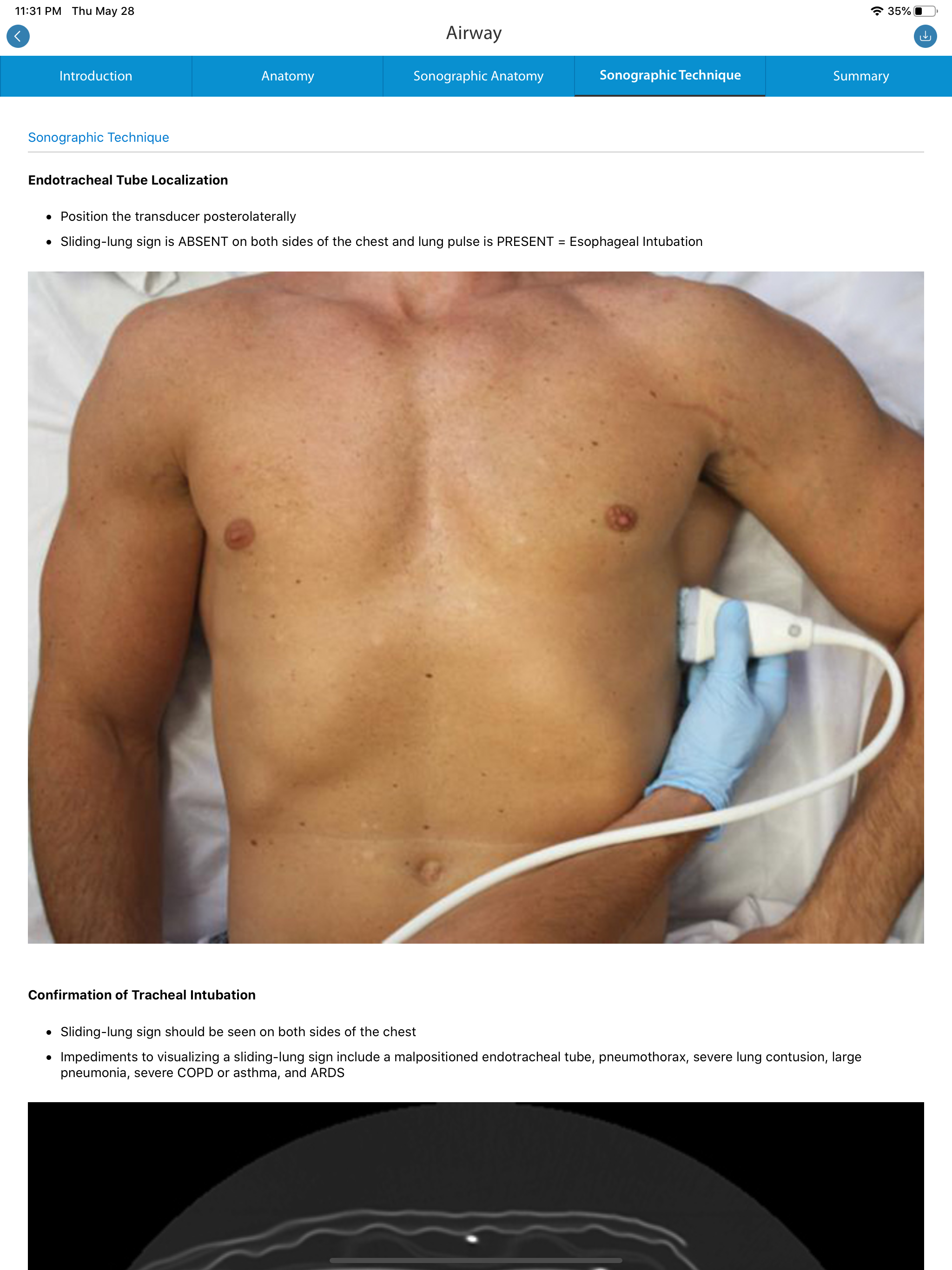 SonoSim