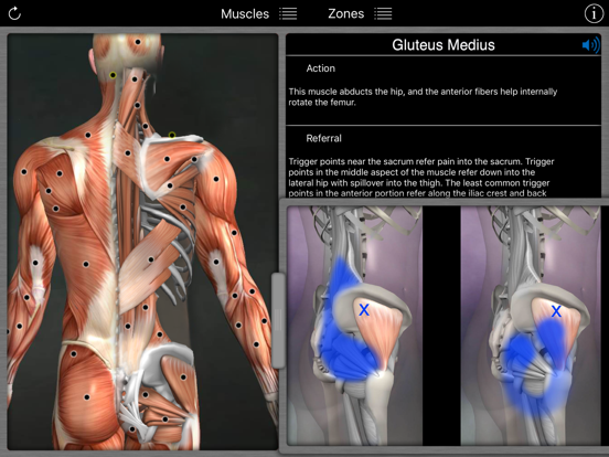 Muscle Trigger Points iPad app afbeelding 1