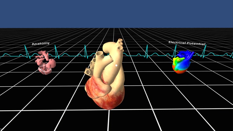 Living Heart for Cardboard VR