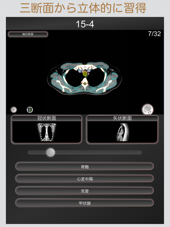 CT PassQuiz 胸部 / MRIのおすすめ画像3