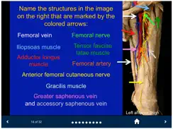 MSK Anatomy - SecondLook iPad image 4