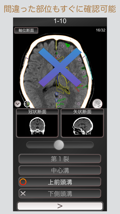 CT PassQuiz 頭部/脳 /CT断面図解剖MRIのおすすめ画像2