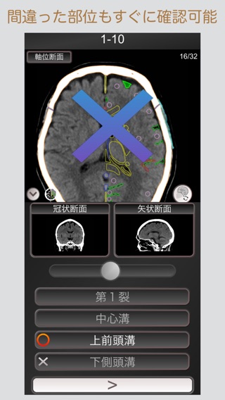 CT PassQuiz コンプリートセット 脳・腹部・胸部のおすすめ画像2