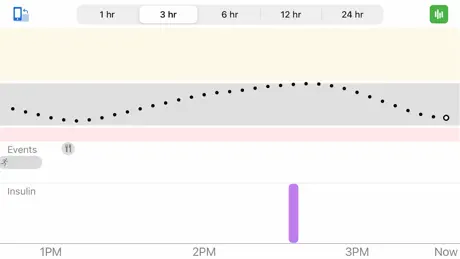 Dexcom G6