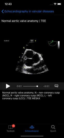 Game screenshot CARDIO3®Echocardiography hack