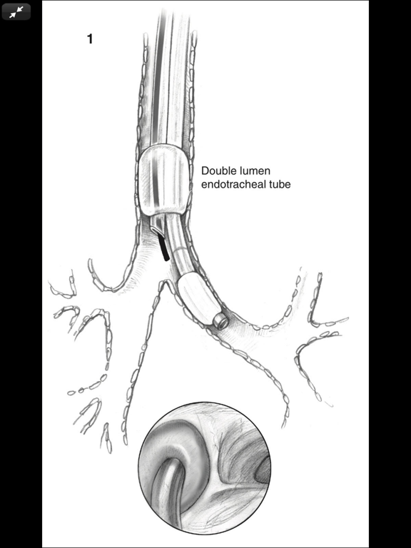 Atlas of Min. Invasive Surgeryのおすすめ画像7