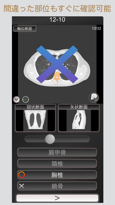 CT PassQuiz 胸部 / MRIのおすすめ画像2