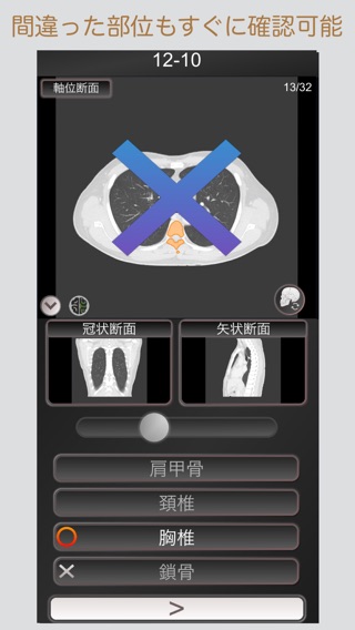 CT PassQuiz コンプリートセット 脳・腹部・胸部のおすすめ画像6