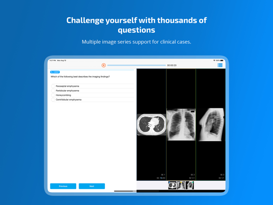 Screenshot #4 pour QEVLAR Radiology
