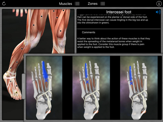 Muscle Trigger Points iPad app afbeelding 3