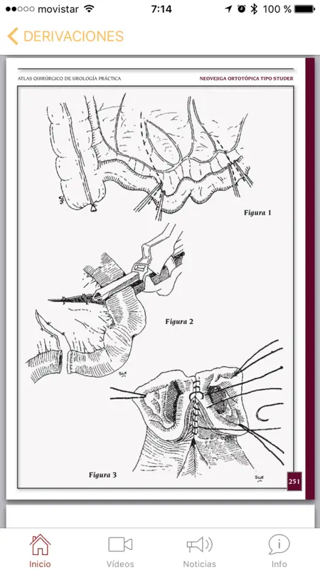 Atlas Quirúrgico de Urología screenshot 5 of 5