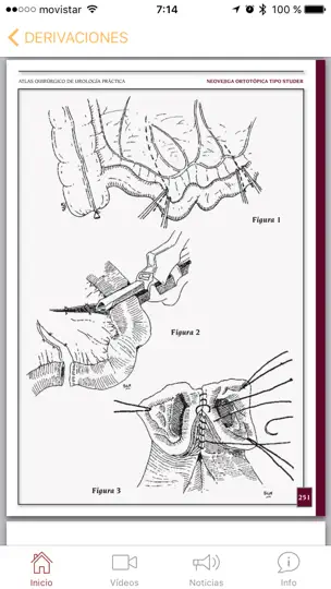 Captura de pantalla de Atlas Quirúrgico De Urología en iPhone 5