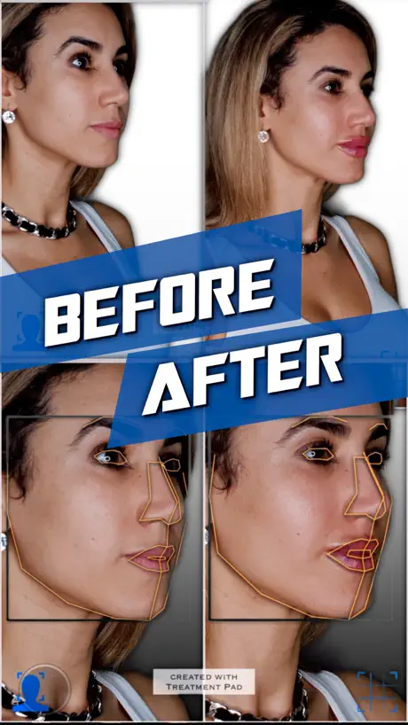 Treatment Pad AI Layout Camera