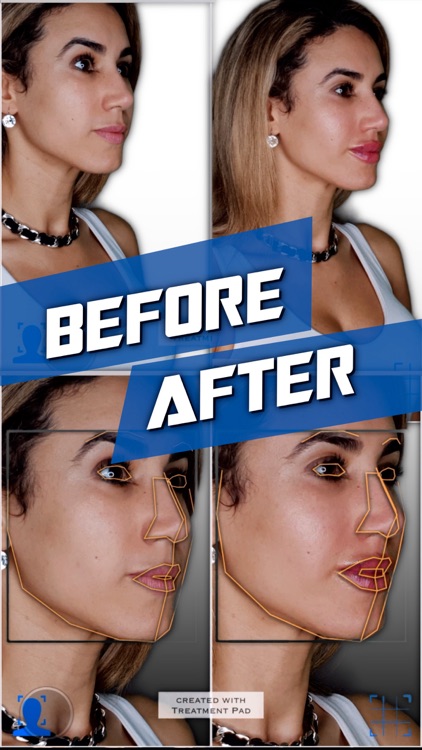 Treatment Pad AI Layout Camera screenshot-0