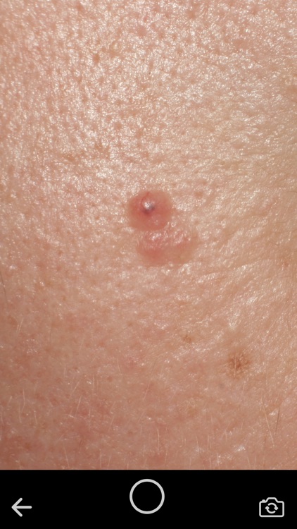 Dermapix Mobile App screenshot-3