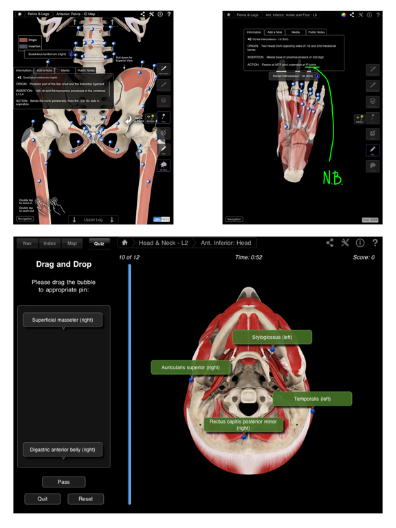 Screenshot #6 pour Muscle System Pro III