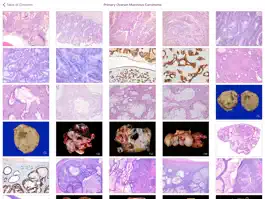 Game screenshot Ovarian Tumor Pathology apk