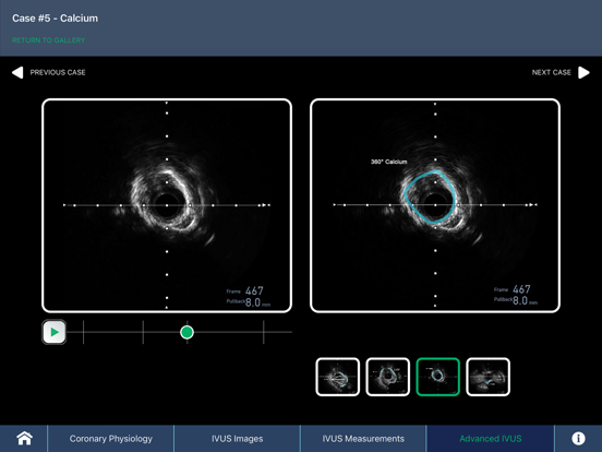 IVUS + Physiology Pro iPad screenshot 5 - Medical app