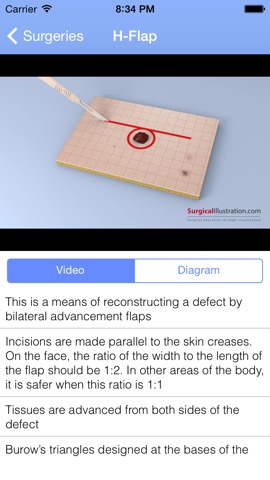 Surgical Flapsのおすすめ画像3