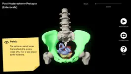 Game screenshot myProlapse apk