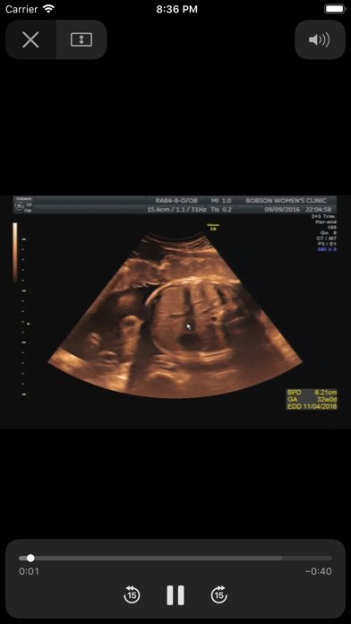 Screenshot #3 pour 易達康超音波平台