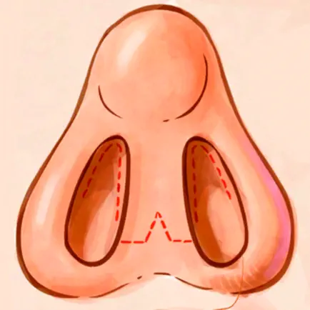 IPO Rinoplastia RA Читы