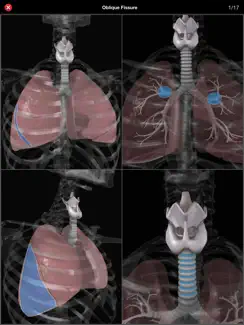 Anatomy Quiz Pro iPad image 3