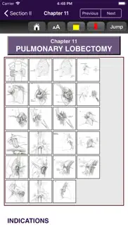 atlas of min. invasive surgery iphone bildschirmfoto 3