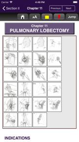Atlas of Min. Invasive Surgery screenshot