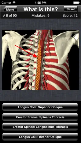 Game screenshot Anatomy Spine Quiz apk