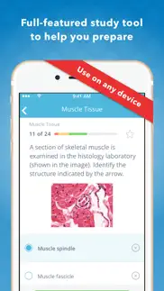 histology: usmle q&a review iphone screenshot 3