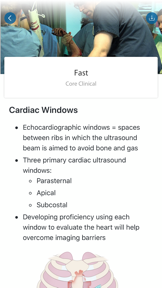 SonoSim screenshot