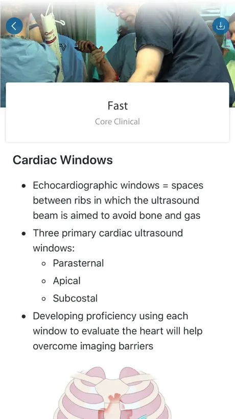 SonoSim