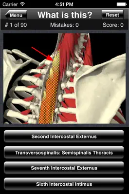 Game screenshot Anatomy Spine Quiz apk