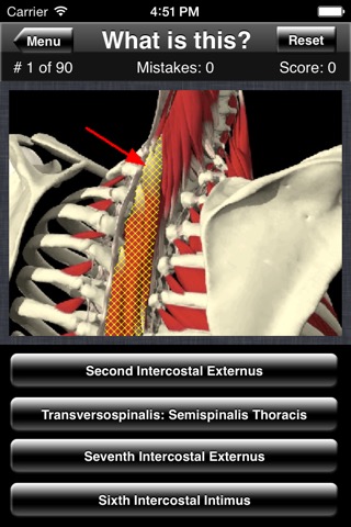 Anatomy Spine Quizのおすすめ画像2