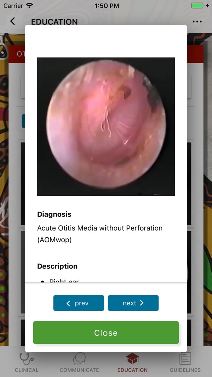 Otitis Media Guidelines screenshot-3